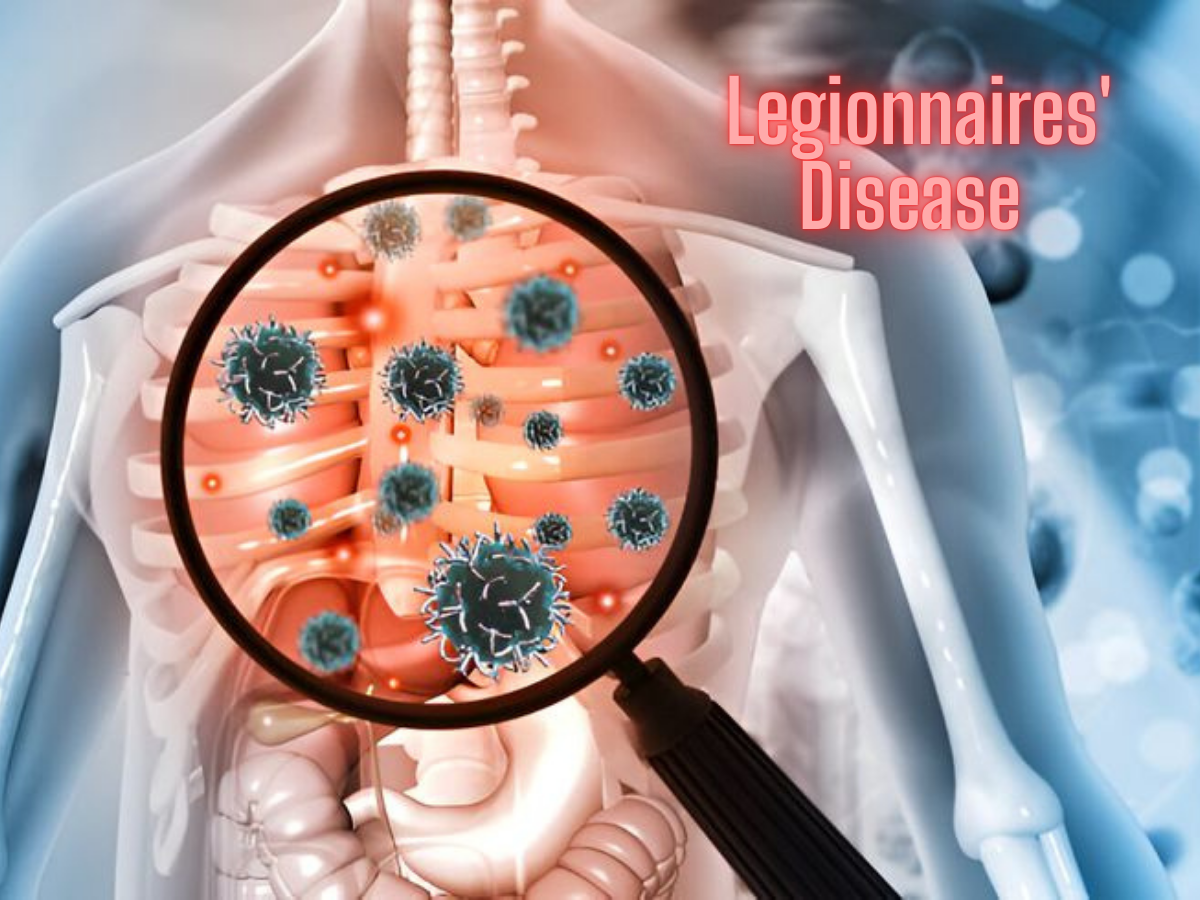 Legionnaires' Disease Symptoms: How It Spreads, Treatment, and Prevention 1 Legionnaires' Disease Symptoms